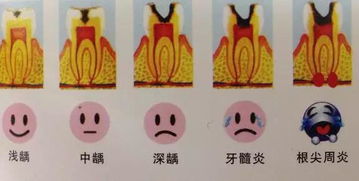 牙齿上出现小黑点,到底有多可怕