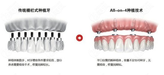 郑州德韩口腔种植牙体验 一家值得信赖的私人牙科