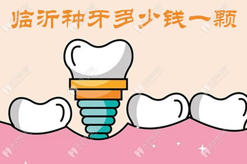 临沂与郑州种植牙费用及半口植体选择指南