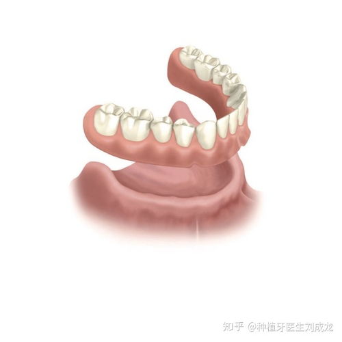 郑州半口/全口即刻种植即刻负载解析与诺贝尔种植技术医生推荐